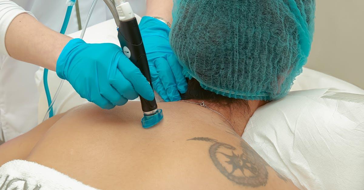 Pożegnaj kolorowy tatuaż: laser Q-Switched w akcji — skutecznie i bezpiecznie